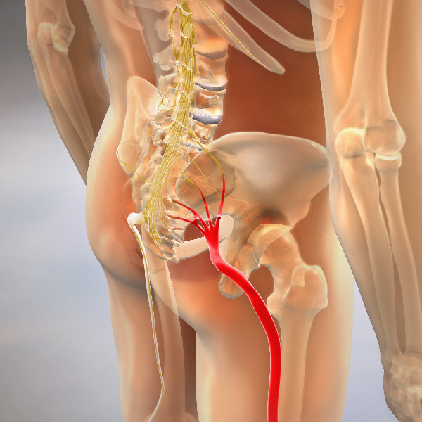 Sciatica Pain Relief in Liberty Hill TX