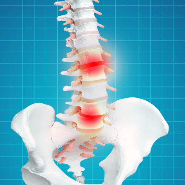 Spine Expert in Liberty Hill 